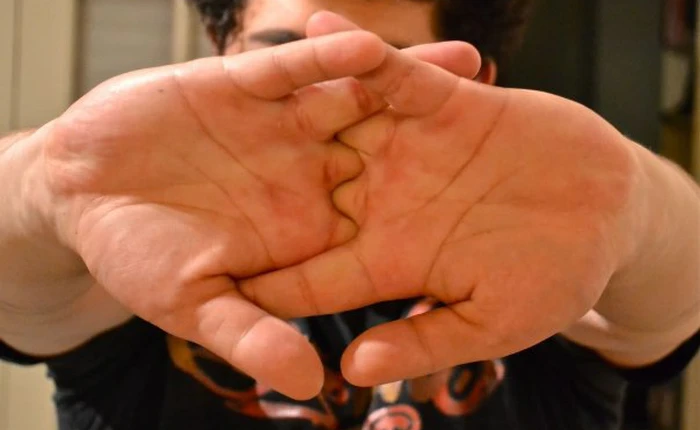 Bẻ tay nhiều có lợi hay có hại?