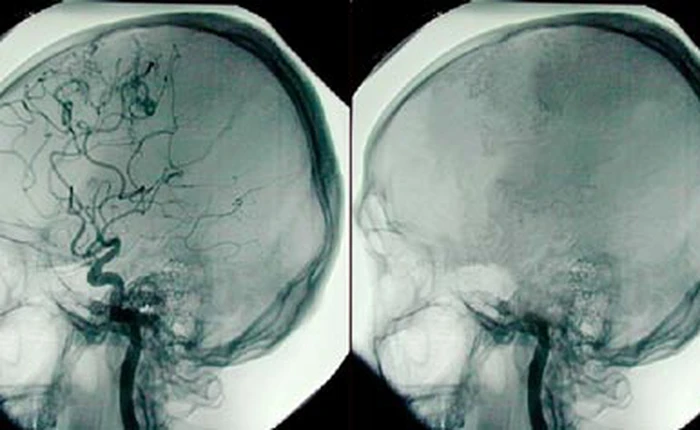Cơ thể con người có thực sự chết nếu não ngừng hoạt động?