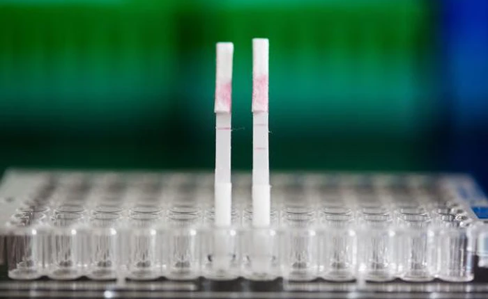 Đột phá trong y học - Phát hiện ung thư bằng xét nghiệm nước tiểu