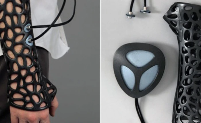 Công nghệ in 3D kết hợp sóng siêu âm giúp làm liền xương gãy nhanh chóng