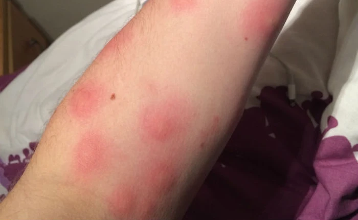 Thăm trung tâm nghiên cứu muỗi dưới lòng thành phố London