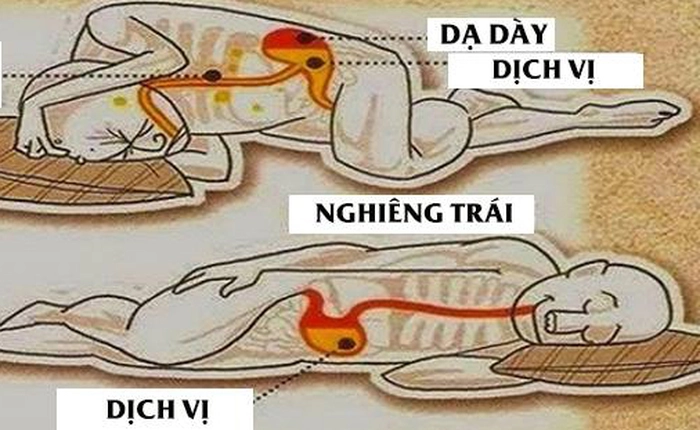 Lý do vì sao bạn chỉ nên nằm ngủ nghiêng bên trái