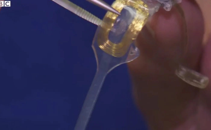 Ca cấy mắt nhân tạo đầu tiên trên thế giới đã thành công