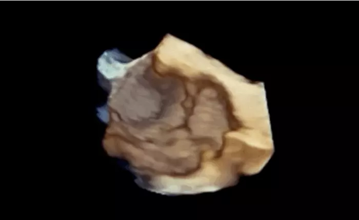 Kỹ thuật siêu âm chụp ảnh trái tim giống như đang hoạt động