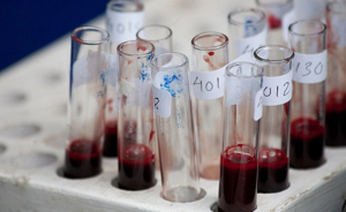 Hội chữ thập đỏ Hoa Kỳ từng bị phạt 46 triệu USD vì dùng... "máu bẩn"