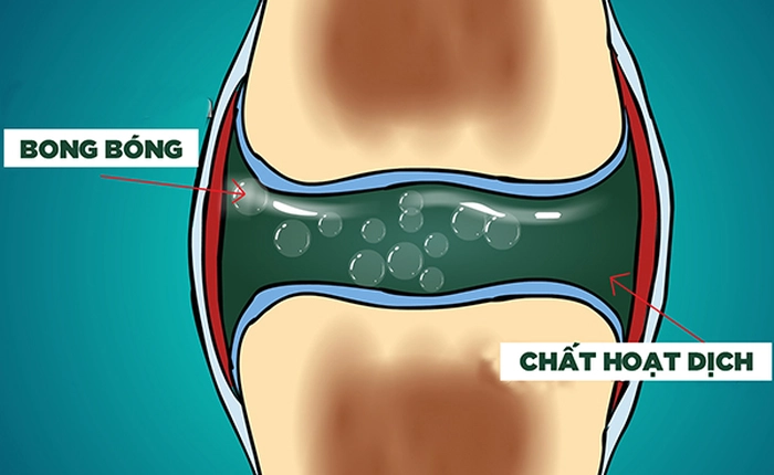 Sau 60 năm, giờ đây người ta mới biết tiếng "lục cục" khi bẻ khớp đến từ đâu