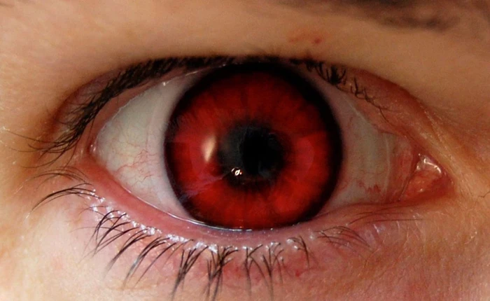 Bước tiến hóa tiếp theo của loài người chính là trở thành Cyborg bất tử