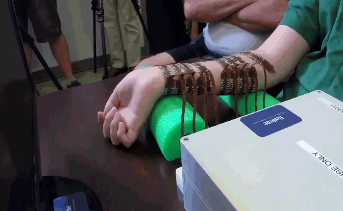 Nhờ cấy ghép não, một người đàn ông bị liệt 6 năm trời đã có thể chơi Guitar Hero