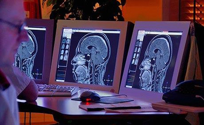 Phát minh ra máy đọc suy nghĩ hiện hình ảnh