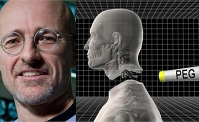 Thông tin gây sốc mới về phẫu thuật cấy ghép đầu người