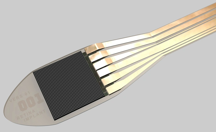 Thử nghiệm thành công chip sinh học chữa bệnh mù lòa