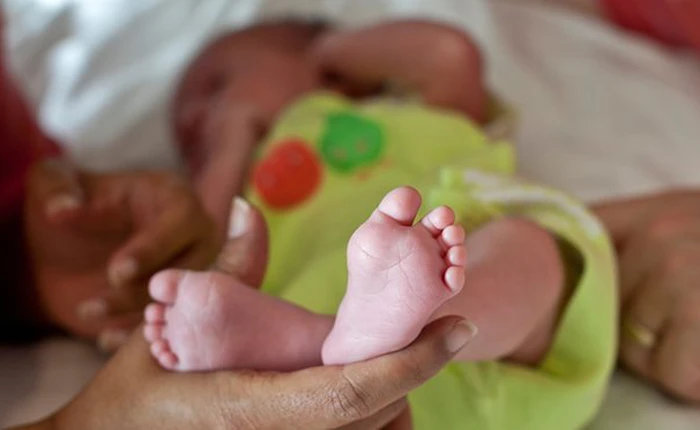 Cặp song sinh khác bố tại Việt Nam làm "sững sờ" các báo phương Tây