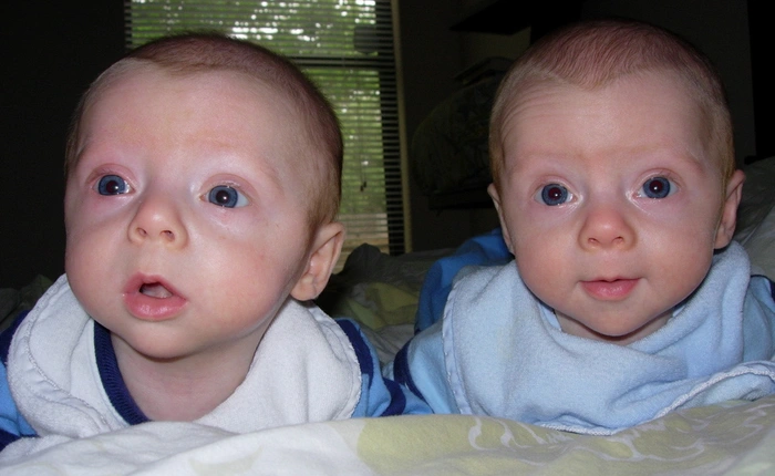 Vợ đẻ sinh đôi không có nghĩa 2 đứa đều là con của bạn