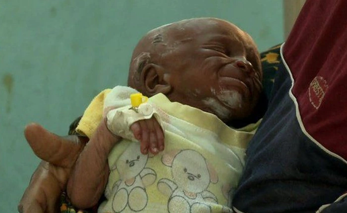 Ngộ độc chì cực kỳ nguy hiểm với trẻ em, hãy chú ý những điều sau để bảo vệ con em mình