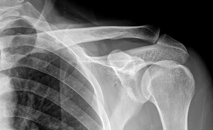 Một khi đã xâm nhập vào cơ thể, chì sẽ hủy hoại bạn như thế nào?