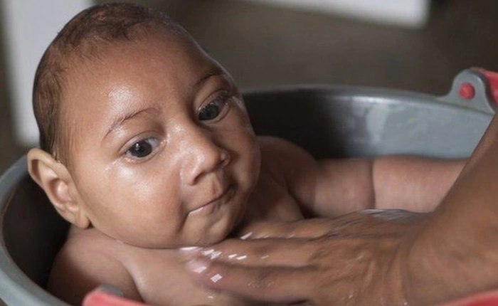 Du khách Australia nhiễm virus Zika sau khi trở về từ VN