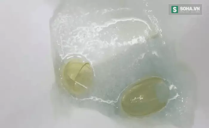 Dầu cá Trung Quốc - Mỹ - Đức - Việt và kết quả bất ngờ! [Thực nghiệm độc quyền]