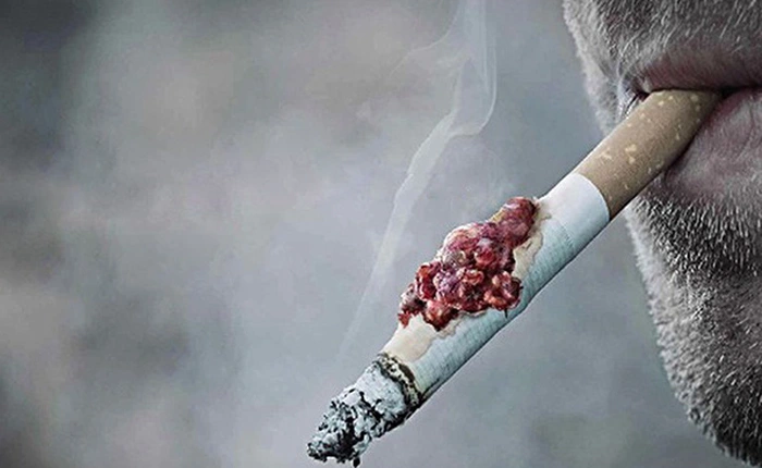 Xét nghiệm máu cho người hút thuốc "nhìn thấy quan tài" trước 5 năm