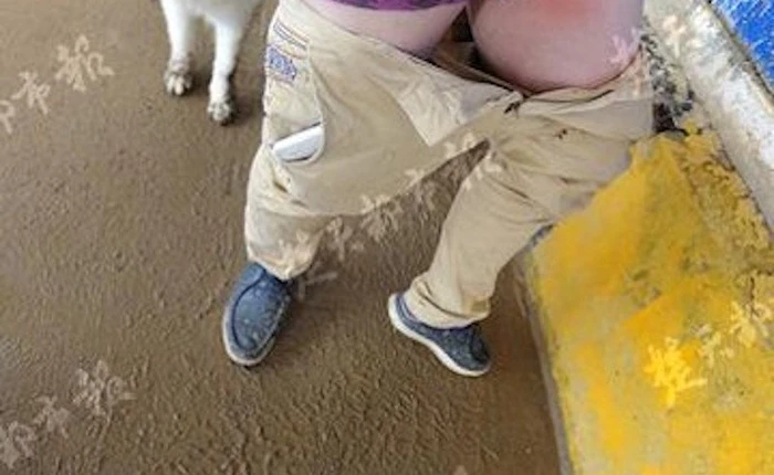 Thanh niên tụt quần giữa phố vì điện thoại bất ngờ bốc cháy ngay trong túi quần