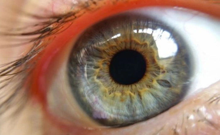 Nối gót Google và Samsung, Sony cũng tham gia thị trường kính áp tròng thông minh