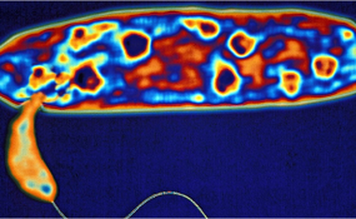 Phát hiện vi khuẩn ăn thịt có thể tiêu diệt các loại vi khuẩn kháng thuốc