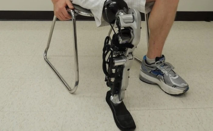 10 bộ phận cơ thể mà các bác sĩ có thể thay thế được