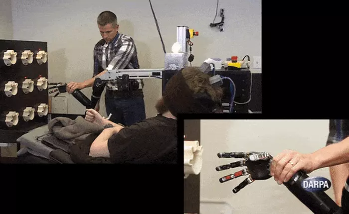 DARPA vừa giúp một người liệt toàn thân có lại "cảm giác đụng chạm" bằng cách cấy chip vào não