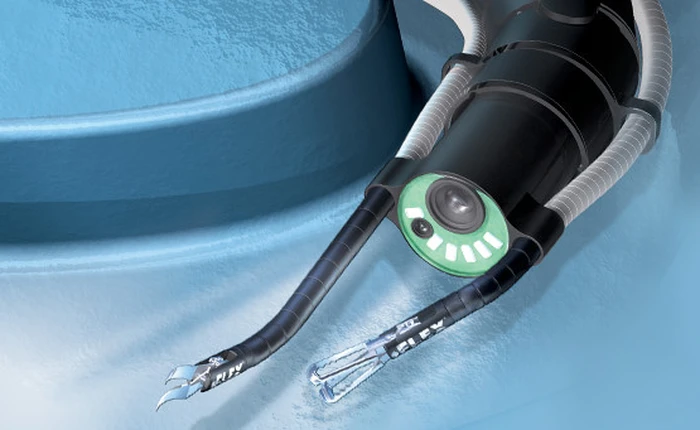 Liệu bạn có chấp nhận để cho robot hình rắn này bò bên trong cơ thể mình để phẫu thuật?