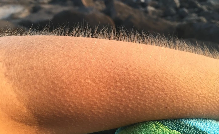 Bạn có biết rằng ngáp, hắt xì hay nổi da gà... chỉ là những cách phòng vệ tự nhiên của cơ thể?