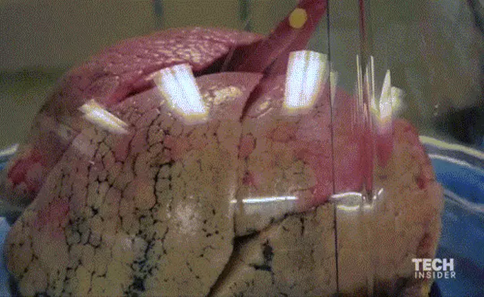 [Video] Làm sao để giữ lá phổi tiếp tục hô hấp ngay cả khi được lấy ra khỏi cơ thể người