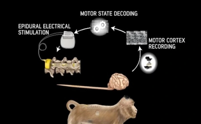 Bệnh nhân bị liệt có thể cử động được nhờ "điều khiển từ xa", đã thử nghiệm thành công với loài khỉ