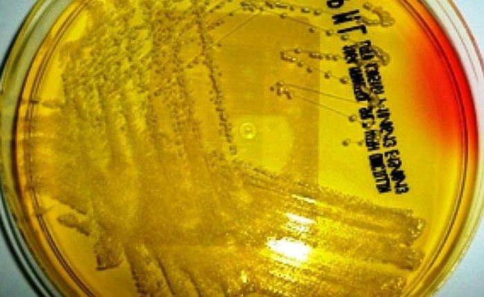 Từ một loài bọt biển, người ta đã tìm ra hợp chất giúp tiêu diệt 98% một loại vi khuẩn kháng kháng sinh