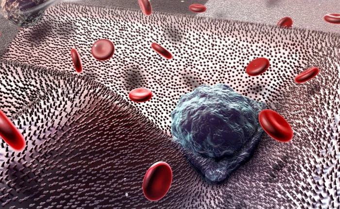 Tế bào ung thư di căn trong cơ thể theo cách đáng sợ hơn bạn tưởng rất nhiều