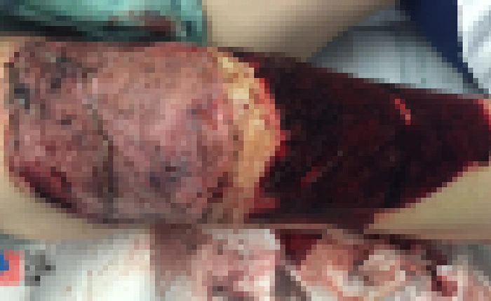 Chưa giải quyết xong Note7, Samsung tiếp tục bị kiện vì S7 Edge phát nổ gây thương tích