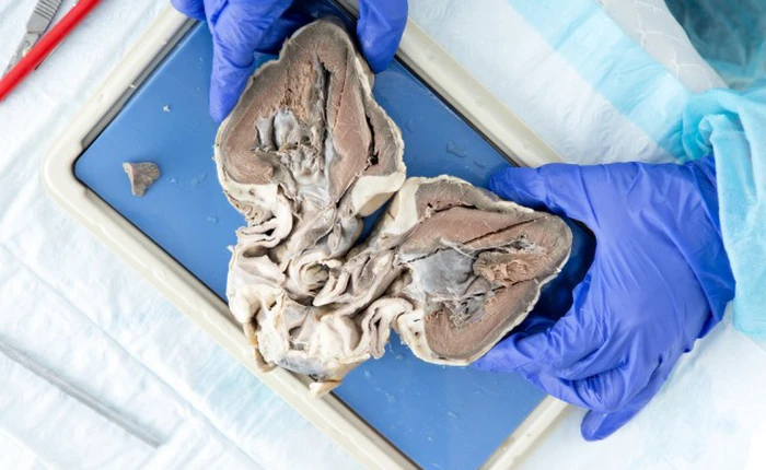 Con người sẽ có thể dùng tim lợn thay cho tim người nhờ kỹ thuật di truyền này