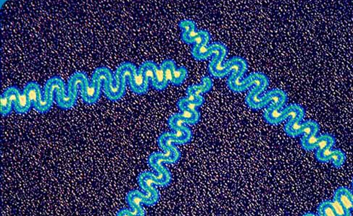 Đây sẽ là căn bệnh tiếp theo không thể được điều trị, vì chủng vi khuẩn kháng thuốc đã lan rộng
