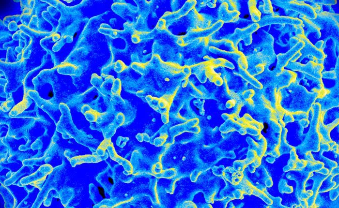 Chữa khỏi bệnh ung thư máu bằng phương pháp mới với hiệu suất thành công 94%