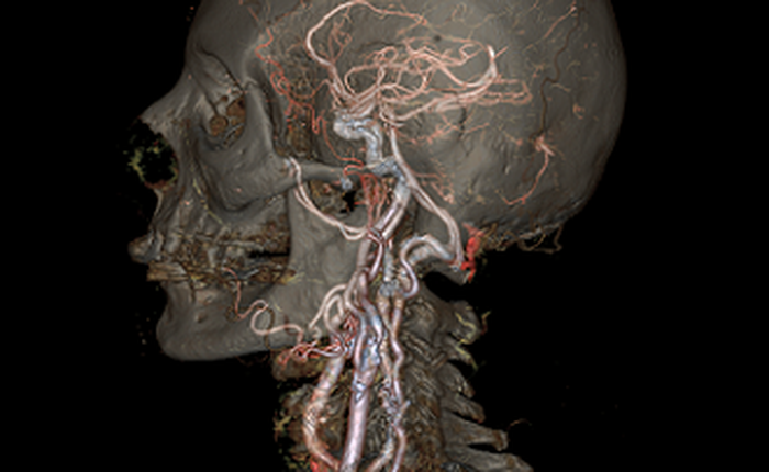 Máy quét HD mang tính cách mạng này sẽ giúp bác sĩ nhìn được bên trong cơ thể bệnh nhân mà không cần mổ