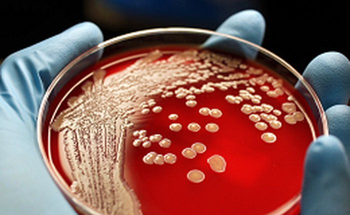 Đại hội đồng Liên Hiệp Quốc nhóm họp khẩn để tìm giải pháp chống vi khuẩn kháng kháng sinh