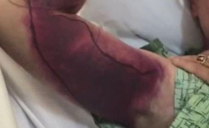 1 tấm ảnh selfie đã phải trả giá bằng 150.000 USD và suýt nữa cả mạng sống như thế nào?