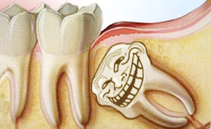 Cơ thể người tồn tại 7 thứ thừa thãi