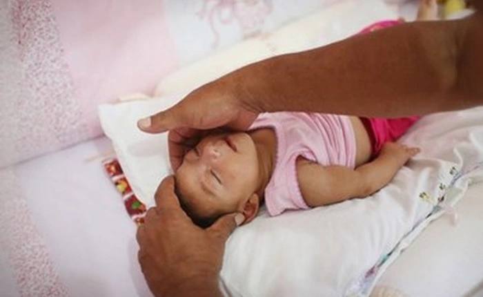 Bộ Y tế: Virus Zika hoàn toàn có khả năng xâm nhập vào Việt Nam