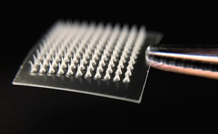 Nghiên cứu mới  ra miếng dán có thể làm tan mỡ thừa dưới da, thử nghiệm thành công mỹ mãn trên chuột