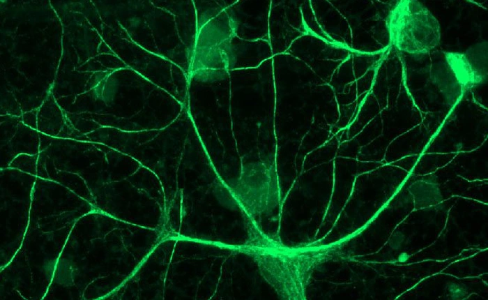 Não bộ chúng ta luôn có xu hướng dự đoán tương lai, bạn có nhận ra điều đó không?