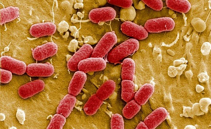 Việt Nam xuất hiện siêu vi khuẩn kháng tất cả kháng sinh