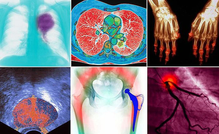 Màu sắc của sự đau đớn: Đây hẳn là những phim chụp y tế trước nay bạn chưa từng thấy