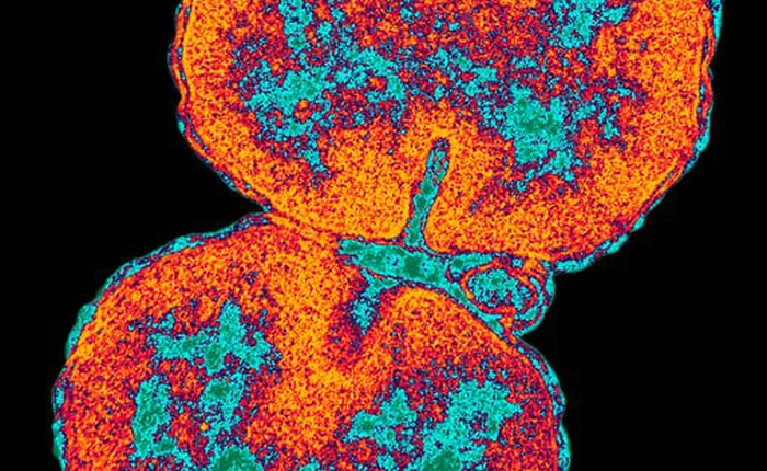 WHO cảnh báo vi khuẩn bệnh lậu kháng tất cả kháng sinh, ít nhất 3 ca bệnh không thể chữa khỏi