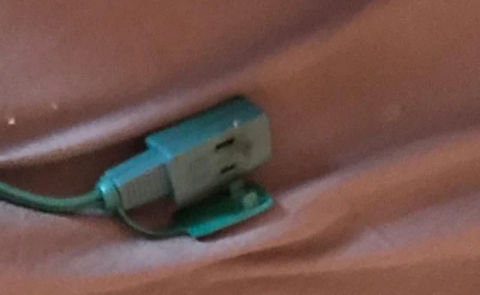 Thêm một trường hợp suýt mất mạng vì sạc iPhone qua đêm trên giường