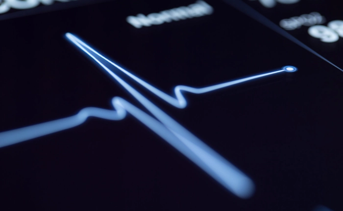 Các thuật toán AI đã có thể dự đoán nguy cơ đột quỵ với độ chính xác cao hơn cả bác sỹ