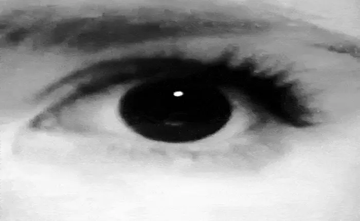 Phẫu thuật cấy ghép nam châm vào hốc mắt để chữa chứng bệnh "mắt nhảy múa"